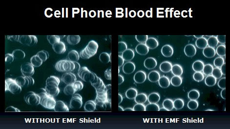 Hedron EMF (Device) Shield