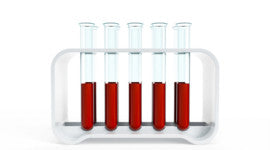 DIY Health Assessment Lab Test